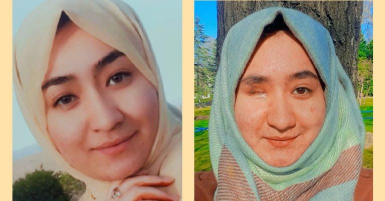 Afghan Student Who Lost An Eye In Terror Attack Vows To Fight For Change